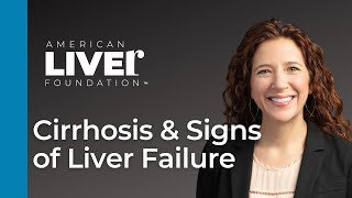 Progression of Liver Disease Webcast Series Cirrhosis and Signs of Liver Failure [upl. by Esiole]