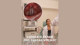 Como é o exame das pregas vocais [upl. by Nosydam]