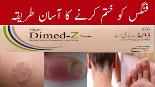 dimed z cream uses in urdu  Fungus Ka Ilaj  Kharish Khatam Karne ka tarika [upl. by Loats]