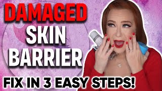 Acne Sensitivity Dry Flaky Skin Fix Your Barrier in 3 Easy Steps [upl. by Hannazus]