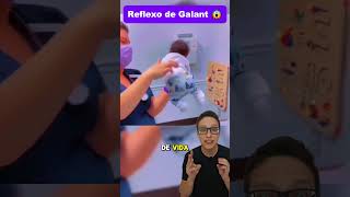 Reflexo de Galant😱👶 medicina medico pediatria enfermagem enfermeira pediatriaonline pediatra [upl. by Eednak]