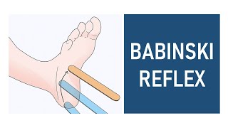 Babinski Reflex Plantar Reflex [upl. by Ellehsram674]