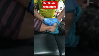 Scoliosis treatment 93085113578409313131 [upl. by Kcirdes]