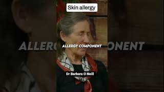 Barbara ONeill talks about skin allergens barbara allergies seafood [upl. by Henrik54]