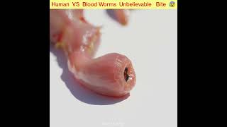 Human VS Blood worm  Worst Bite Ever 😱 short [upl. by Aiker987]