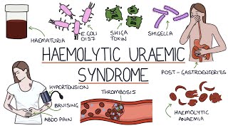 Haemolytic Uraemic Syndrome [upl. by Amzaj339]