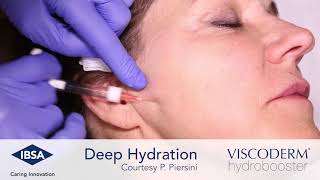 Viscoderm Hydrobooster  Deep Hydration Malar Area [upl. by Blaseio505]