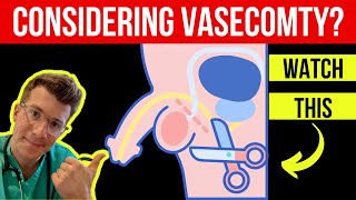 What happens during a VASECTOMY procedure Doctor ODonovan explains [upl. by Nalyorf]