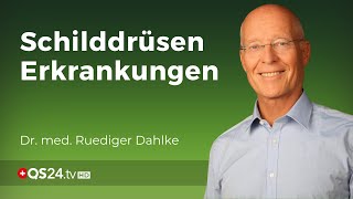 Wenn die Schilddrüse aus der Reihe tanzt  Dr med Ruediger Dahlke  QS24 Gesundheitsfernsehen [upl. by Evreh862]