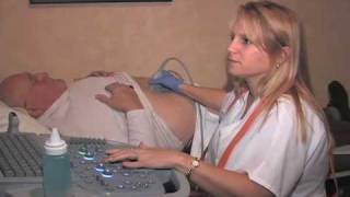 AAA Ultrasound Screening [upl. by Anrehs]