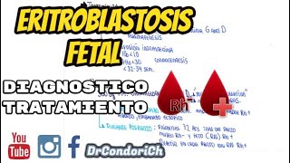 Eritroblastosis Fetal  Diagnostivo y Tratamiento  Incompatibilidad Saguinea [upl. by Mcguire]