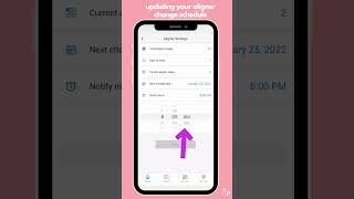 Updating Your Aligner Change Schedule [upl. by Ettesus]