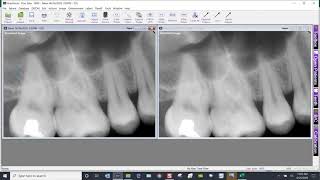 Training Video  XrayVision 4 Printing Multiple Images [upl. by Ayikan]