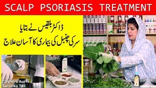 Scalp Psoriasis Treatment by Dr Bilquis  Chambal ka Ilaaj  چنبل کی بیماری کا علاج [upl. by Zaneta]