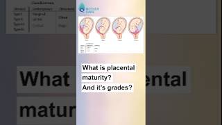 What is Placenta Maturity  Dr Supriya Puranik mothercare drsupriyapuranik placentamanturity [upl. by Darian]