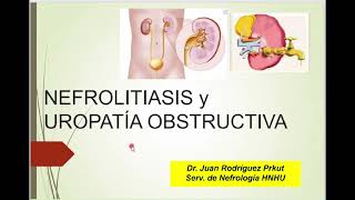 MI1  TEO 72  NEFROLITIASIS Y UROPATÍA OBSTRUCTIVA ‐ 2024 [upl. by Naara]