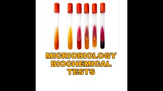 Biochemical Tests for Bacterial IdentificationTSIUrease Citratemicrobiology Biochemical tests [upl. by Mckee519]