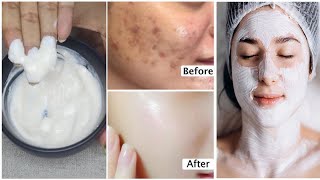 Best Homemade Facial for Skin Whitening Natural Glow amp Brightening Remedy [upl. by Botzow]