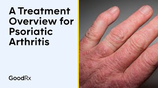 A Treatment Overview for Psoriatic Arthritis  GoodRx [upl. by Cortney]