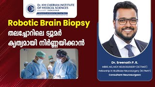 Robotic Brain Biopsy തലച്ചോറിലെ ട്യൂമർ കൃത്യമായി നിർണ്ണയിക്കാൻ  Dr Sreenath P R [upl. by Natal]