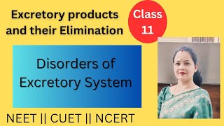 Disorders of Excretory System  Excretory products and their Elimination  Biology class 11 [upl. by Amabel]