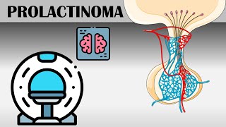 PROLACTINOMA👀 ¿Qué es cuales son sus síntomas y tratamientos  Dr Vargas [upl. by Aissert91]