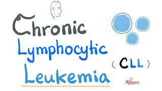 Chronic Lymphocytic Leukemia CLL  Etiology Risk Factors Symptoms Signs Diagnosis Treatment [upl. by Frodin]