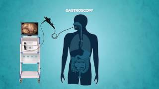 Gastrocopy [upl. by Esirec]