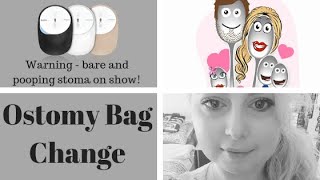 Ostomy Bag Change  The Spoonie Mummy [upl. by Yralih240]