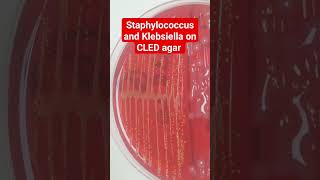 Staphylococcus and Klebsiella Colony Morphology on CLED Agar [upl. by Tawnya243]