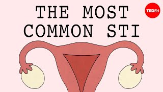 The most common STI in the world  Emma Bryce [upl. by Targett]