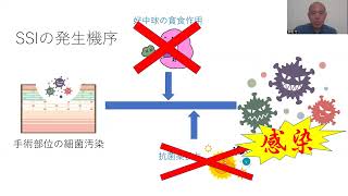 みんなで防ぐSSI～基礎と危険因子の巻～ [upl. by Fassold935]