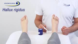 Verbandanlage nach minimalinvasiver Hallux rigidusOperation [upl. by Nylrac]