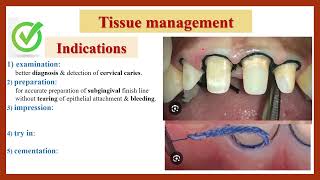 Tissue Management Gingival Retraction Indications amp Requirements دواعي ابعاد اللثة ومتطلباتها [upl. by Suinotna808]