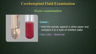 Cerebrospinal Fluid Examination CSF [upl. by Adekam442]