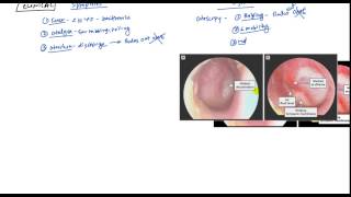 Acute Otitis Media and Otitis Media with Effusion for USMLE Step 2 [upl. by Dayle]