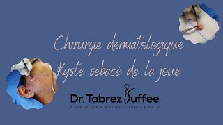 Chirurgie dermatologique [upl. by Ahcas]