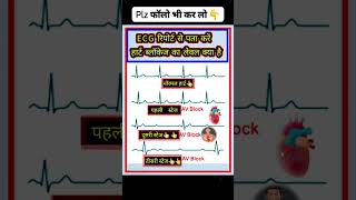 ECG Report stage ecg education gk [upl. by Nigel]