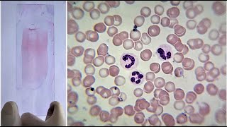 Blood Smear Preparation and Staining Practical Lab [upl. by Airdnua]