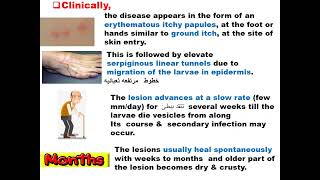 Ancylostoma caninum amp Toxocara GIT module Dr khaled habib [upl. by Arahsat]