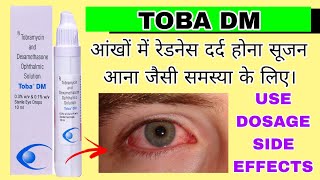 Toba DM eye drop uses in Hindi  Tobramycin and Dexamethasone Opthalmic Solution [upl. by Wehtta]