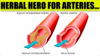 1 Herb a Day Helps Clear Clogged Arteries Away  Amazing Tips [upl. by Yrrok]