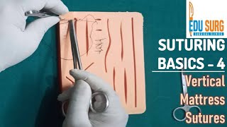 Vertical mattress suture l OSCE skill station l Suturing techniques part 3 [upl. by Nahtahoj]