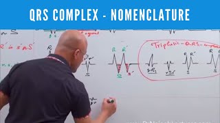 ECG  QRS Complex in EKG  Nomenclature  Electrocardiography🫀 [upl. by Ymor218]