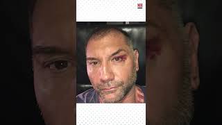 Dave Bautista has had some pretty gnarly injuries menshealth [upl. by Ahsekim490]