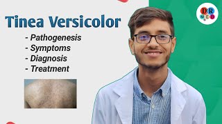 Superficial mycoses  Tinea Versicolor  Malassezia furfur  Microbiology bangla lecture [upl. by Lebasile241]