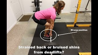 Strained Back or Bruised Shins from Deadlifts [upl. by Enelrahs]