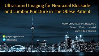 Ultrasound Imaging in Obesity for Epidural  Spinal Anesthesia amp Lumbar Puncture [upl. by Moor95]