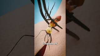 Using Ants To Stitch Wounds 🐜 [upl. by Zetnod]