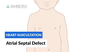 Atrial Septal Defect  Heart Auscultation  Episode 7 [upl. by Enrev905]